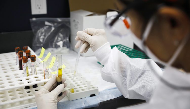 Food and its packaging are very unlikely to transmit viruses

