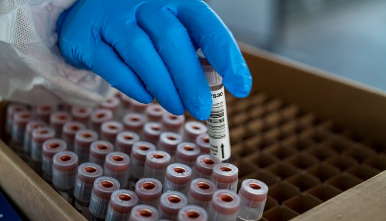 Researchers identify five new cases of variants in California

