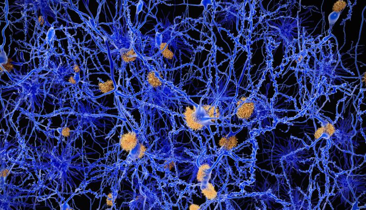 Eli Lilly is recruiting black patients for Alzheimer's trials as drugmakers seek diversity in clinical trials

