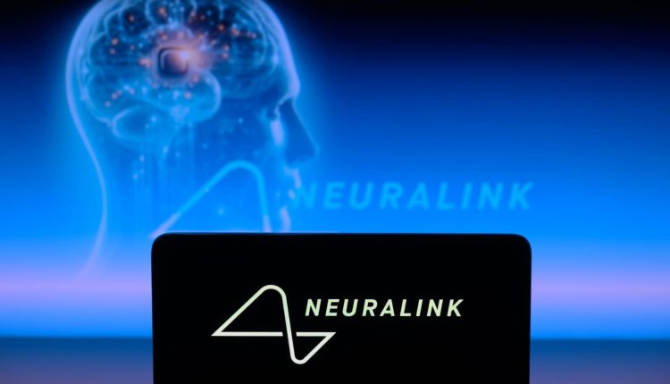 Neuralink shows video of patient chess player involving brain implant