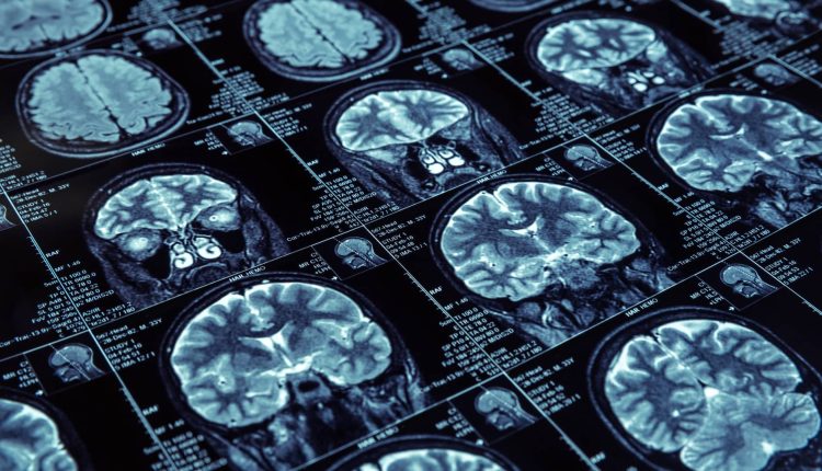 A new battle for privacy is underway as technological devices record our brain waves

