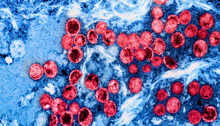 Healthcare stocks rise after WHO declares global health emergency

