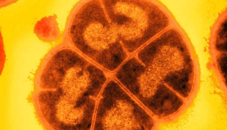 These superbugs can withstand enough radiation to kill a human

