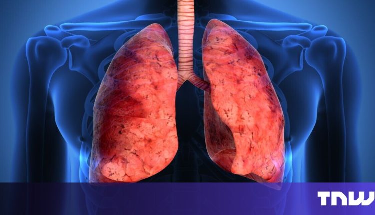 Bioprinted organs '10 –15 years away, ”says Startup, which regenerating skin

